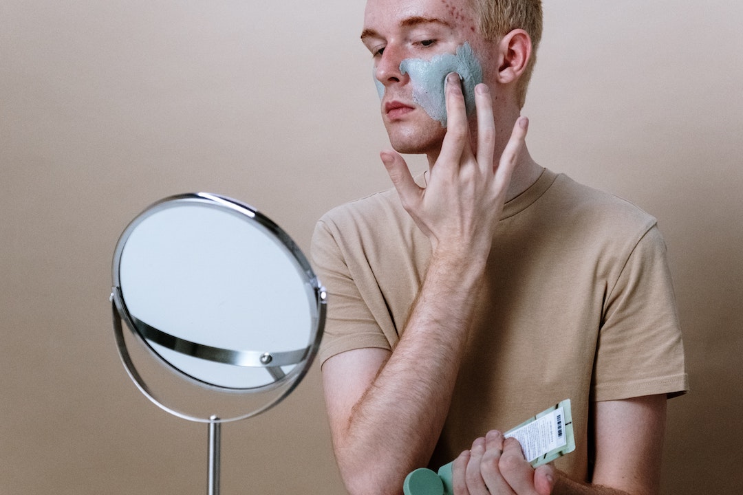 how to get rid of acne scars
